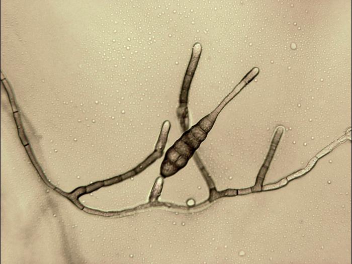 Alternaria_tagetica-03_LQ