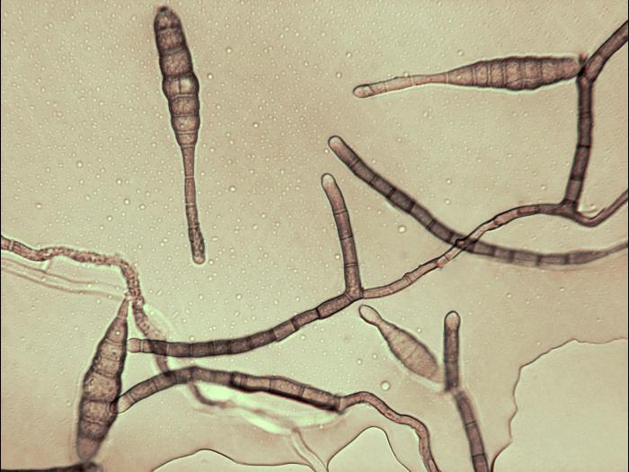 Alternaria_tagetica-06_LQ