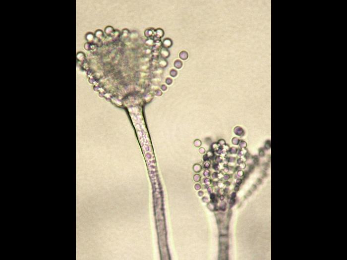 Aspergillus-21_LQ