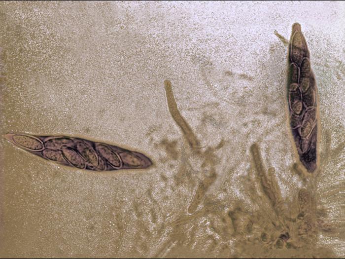 Botryosphaeria_02_LQ