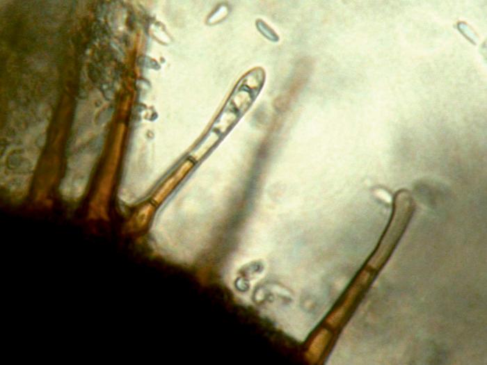 Chaetomella-05_LQ
