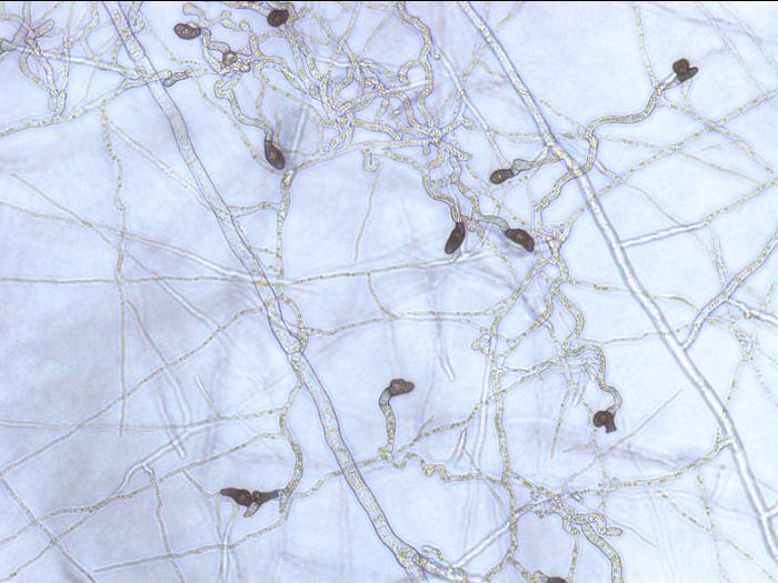 Colletotrichum_Appressoria_D50604-2_LQ