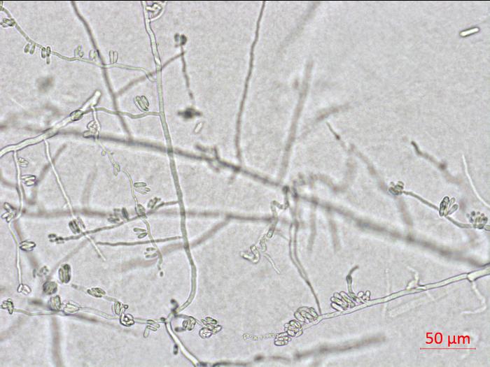 Colletotrichum_coccodes_D35079-1_LQ