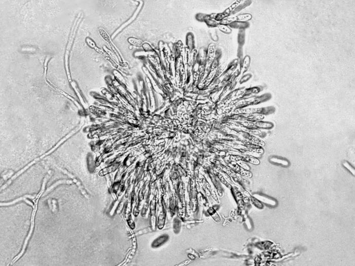 Colletotrichum_gloeosporioides-02