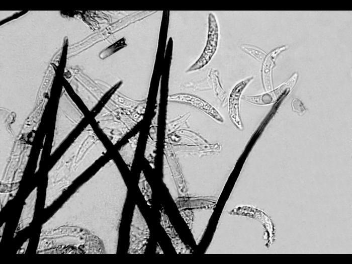 Colletotrichum_graminicola-04_LQ