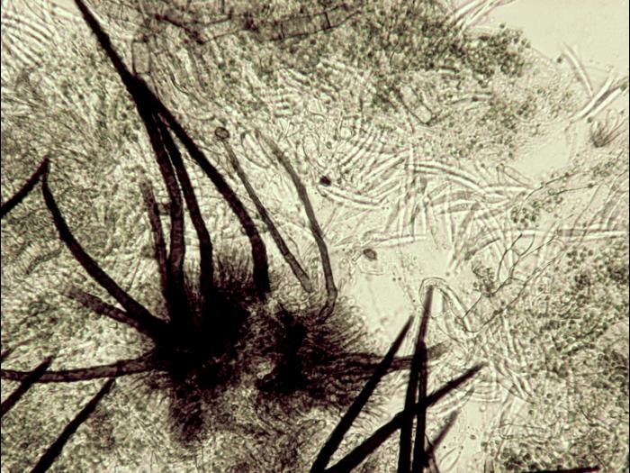 Colletotrichum_truncatum-10