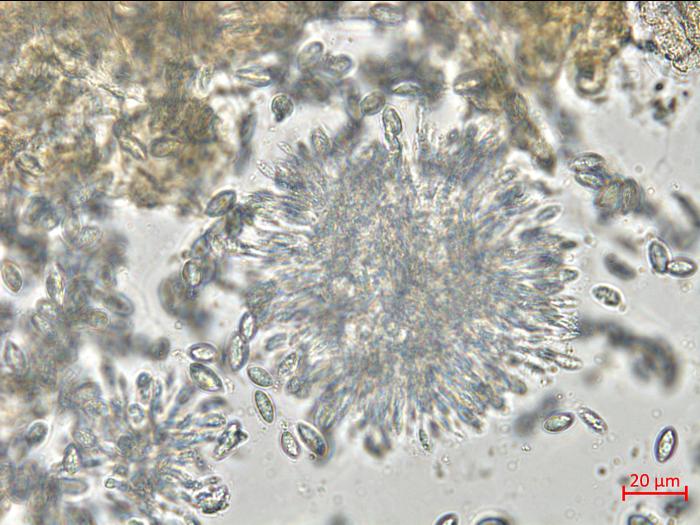 Coniella_diplodiella_D33070-1_LQ