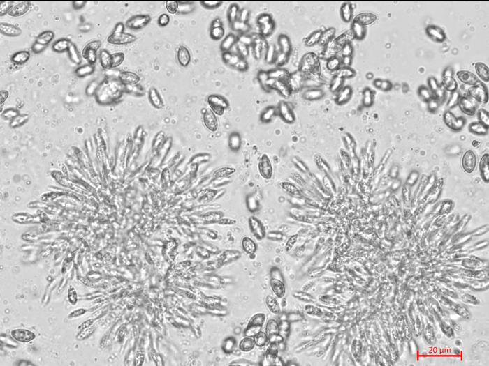 Coniella_diplodiella_D33070-3_LQ