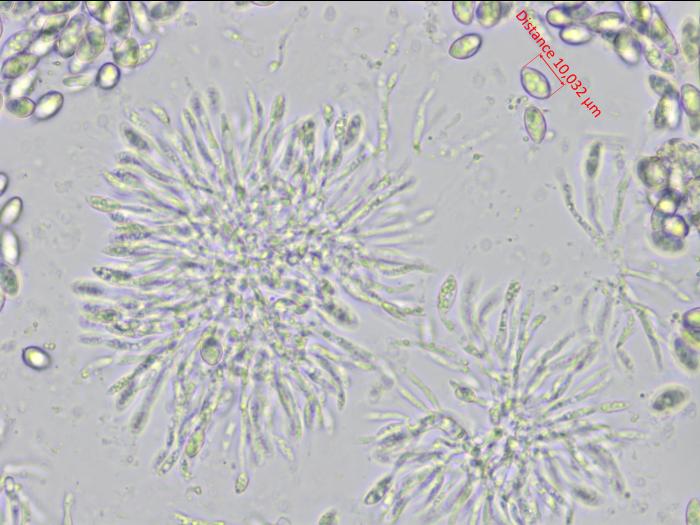 Coniella_diplodiella_D33070-4