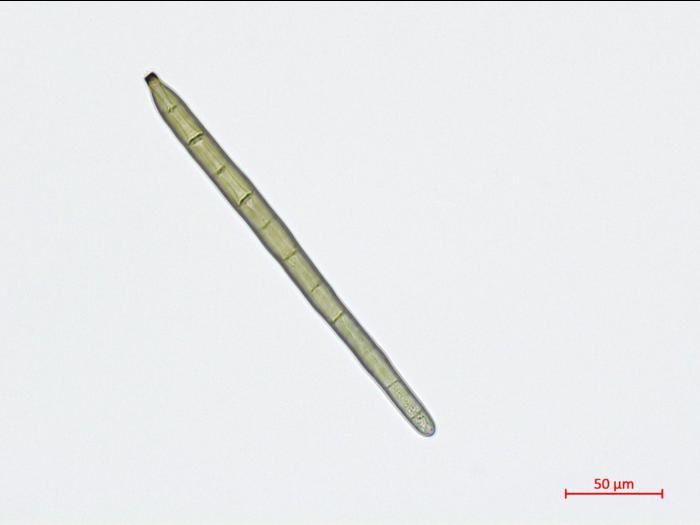 Corynespora_cassiicola_D55060-2_Conidie_LQ