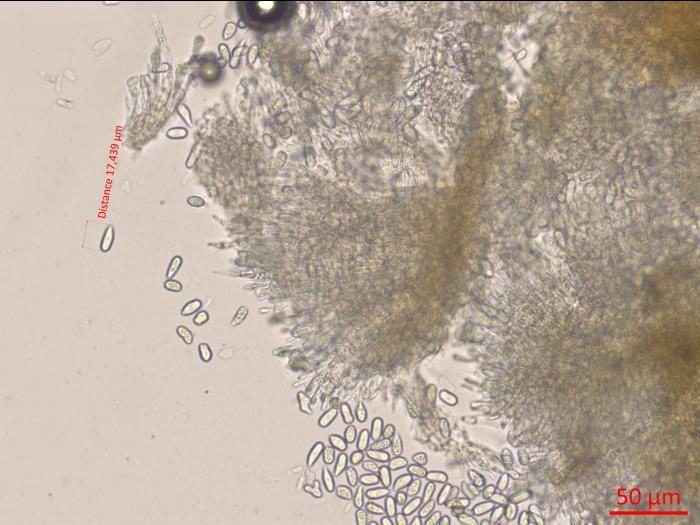 Cryptosporiopsis_tarraconensis_D42630_Conidiophores_Conidies