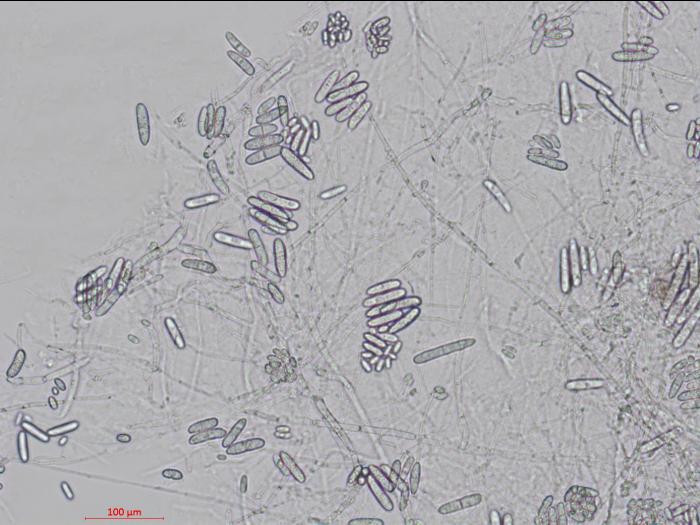 Cylindrocarpon_D27080-2_LQ