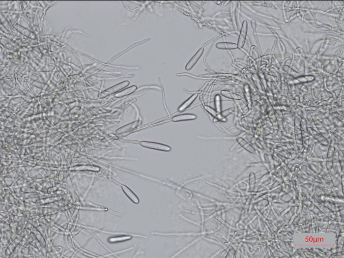 Cylindrocarpon_D34576_LQ