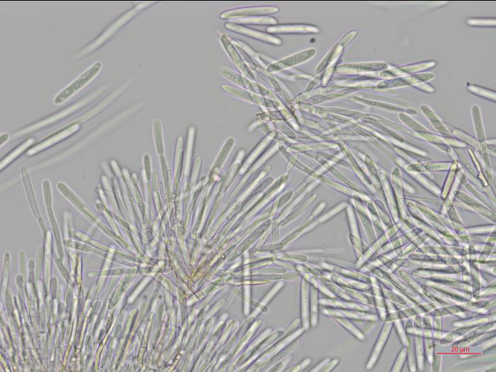 Cylindrocarpon_D34903_LQ