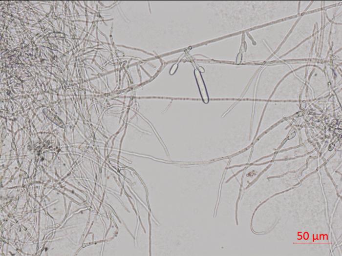 Cylindrocarpon_D44139_LQ