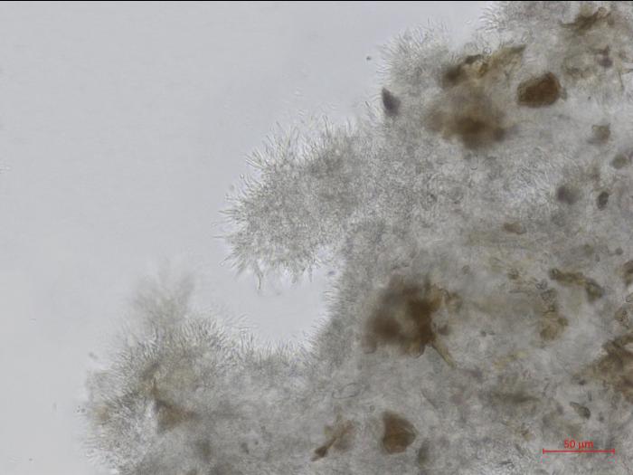 Cytospora_leucostoma_D44677-1_Conidiophores_LQ