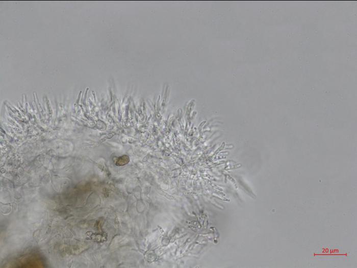 Cytospora_leucostoma_D44677-2_Conidiophores_LQ