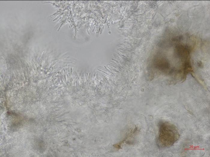 Cytospora_leucostoma_D44677-3_Conidiophores_LQ