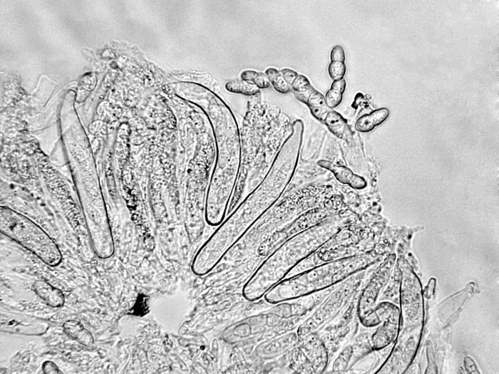 Didymella_applanata_1