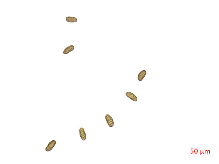 Diplodia_seriata_D45811_LQ