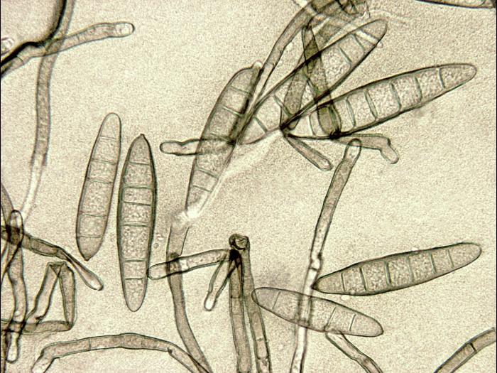 Exserohilum turcicum (Drechslera turcica)-01-ret