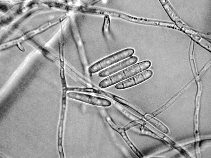 cylindrocarpon-16-ret