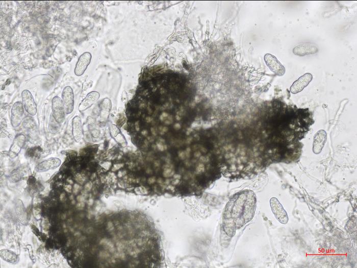 Leptosphaerulina_sp_1