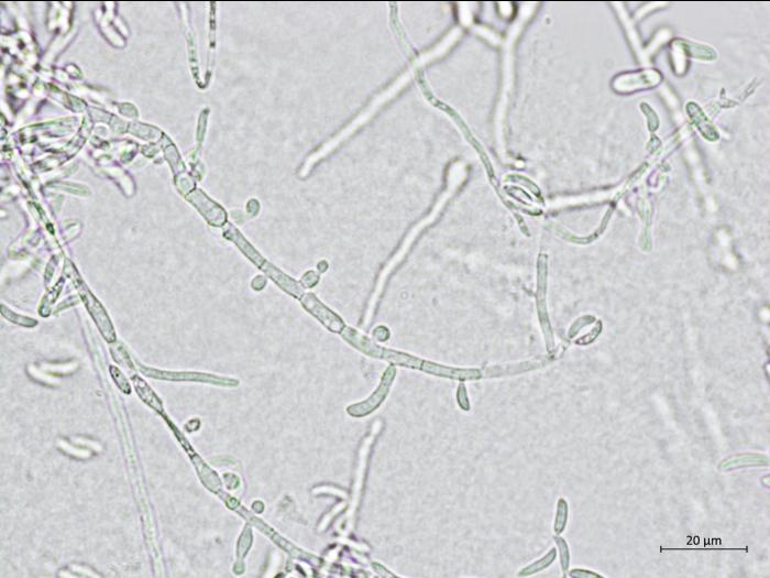 Microdochium_sp_3