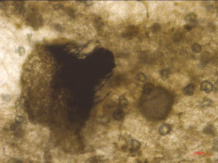 Physalospora_vaccinii_3