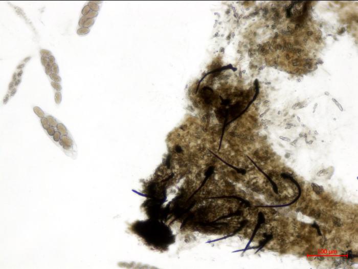 Physalospora_vaccinii_1