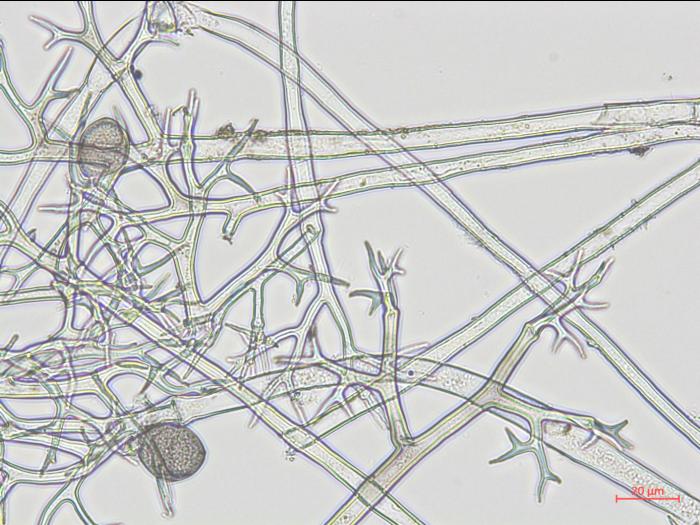 Pseudoperonospora_sp_1