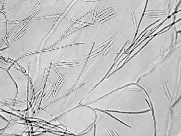 Fusarium_avenaceum_2