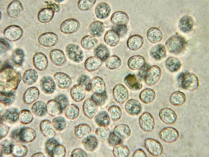 Phyllosticta_ampelicida_2