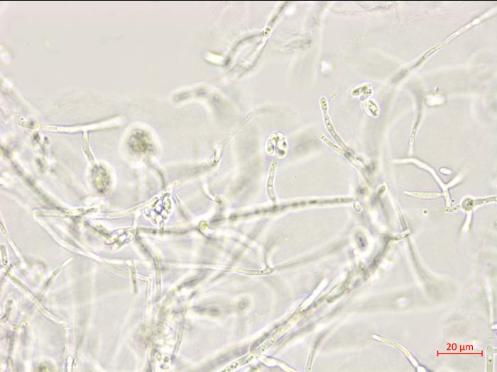Plectosporium_tabacinum_1