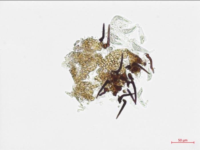 Protoventuria_myrtilli_1