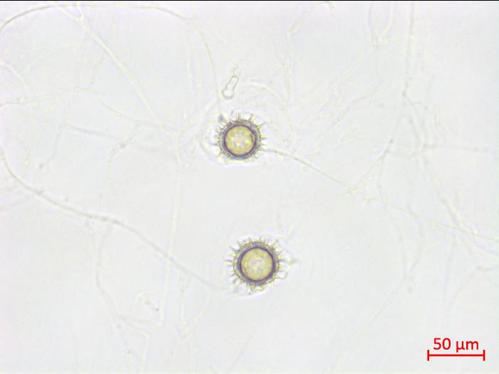 Pythium_uncinulatum_2