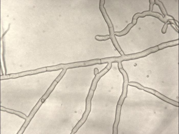 Rhizoctonia_sp_1