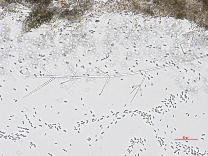 Verticillium_dahliae_3