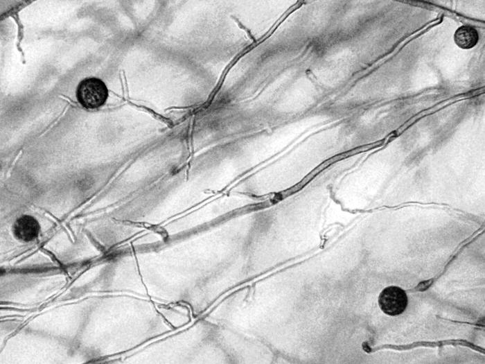 Pythium_dimorphum_1