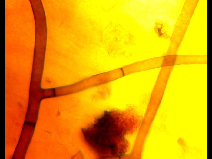 Rhizoctonia_solani_2