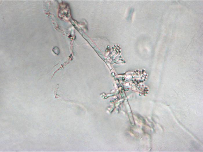 Sclerotium cepivorum conidiophores