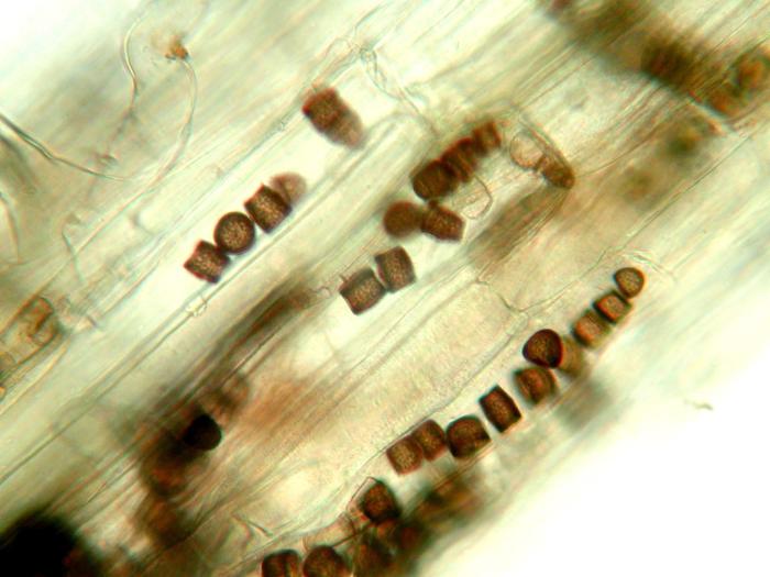 Chlamydospores de Berkeleyomyces basicola (syn. Thielaviopsis basicola)