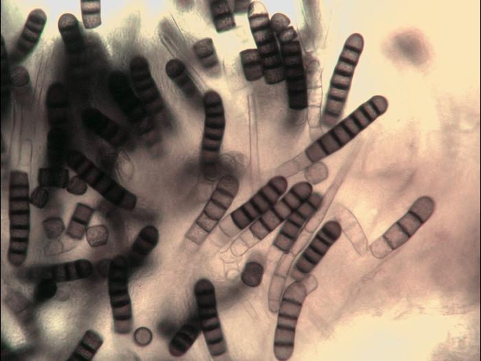 Chlamydospores de Berkeleyomyces basicola (syn. Thielaviopsis basicola)