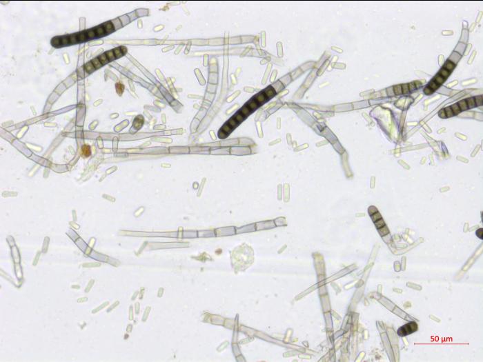 Chlamydospores et conidies de Berkeleyomyces basicola (syn. Thielaviopsis basicola)