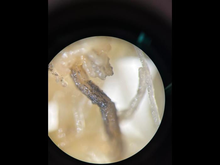 Chlamydospore de Berkeleyomyces sp. (syn. Thielaviopsis) racines cannabis