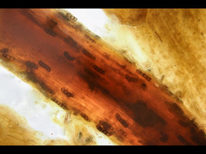 Berkeleyomyces basicola (syn. Thielaviopsis basicola) racine laitue