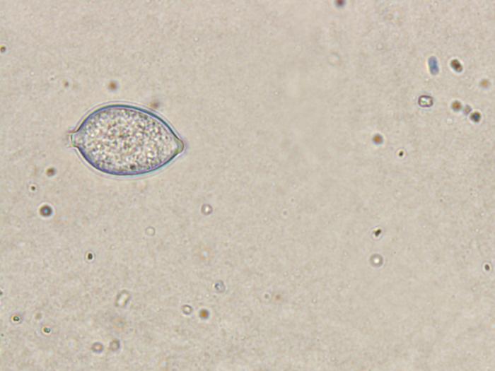 Phytophthora_infestans_2