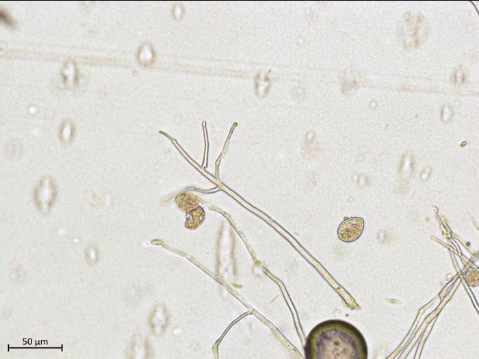 Phytophthora_infestans_3