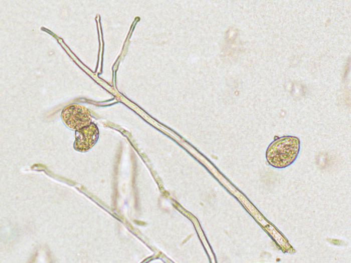 Phytophthora_infestans_4