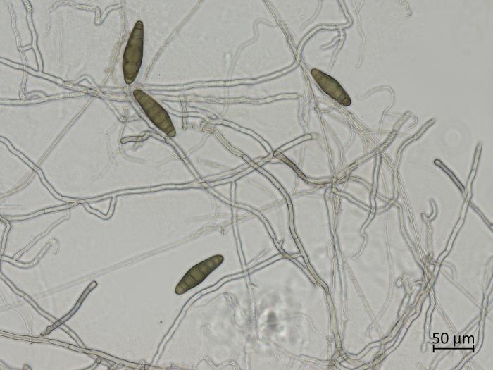 Bipolaris_sorokiniana_1